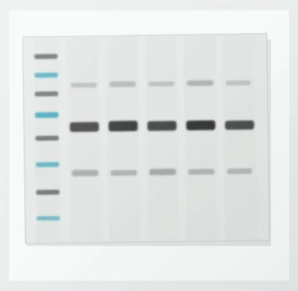Western blot membrane with non-specific bands around a mitochondrial marker